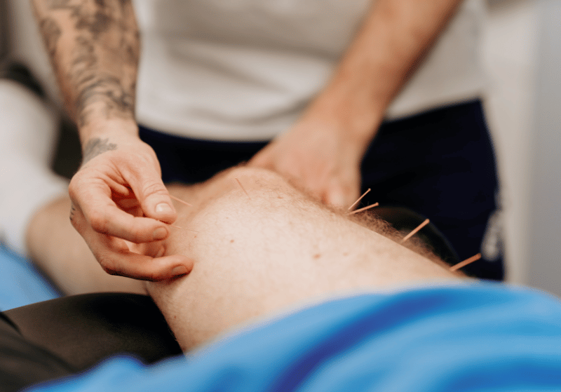 Medical Acupuncture 7