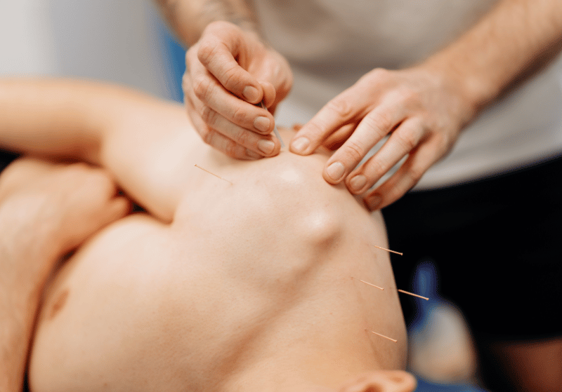 Medical Acupuncture 9